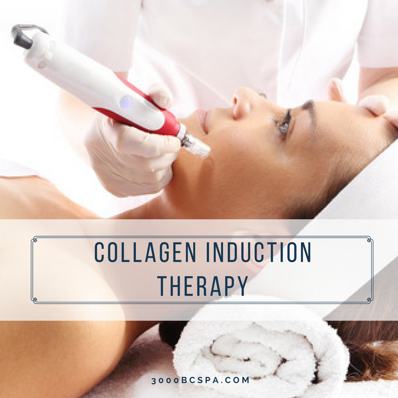 3000collageninductiontherapy